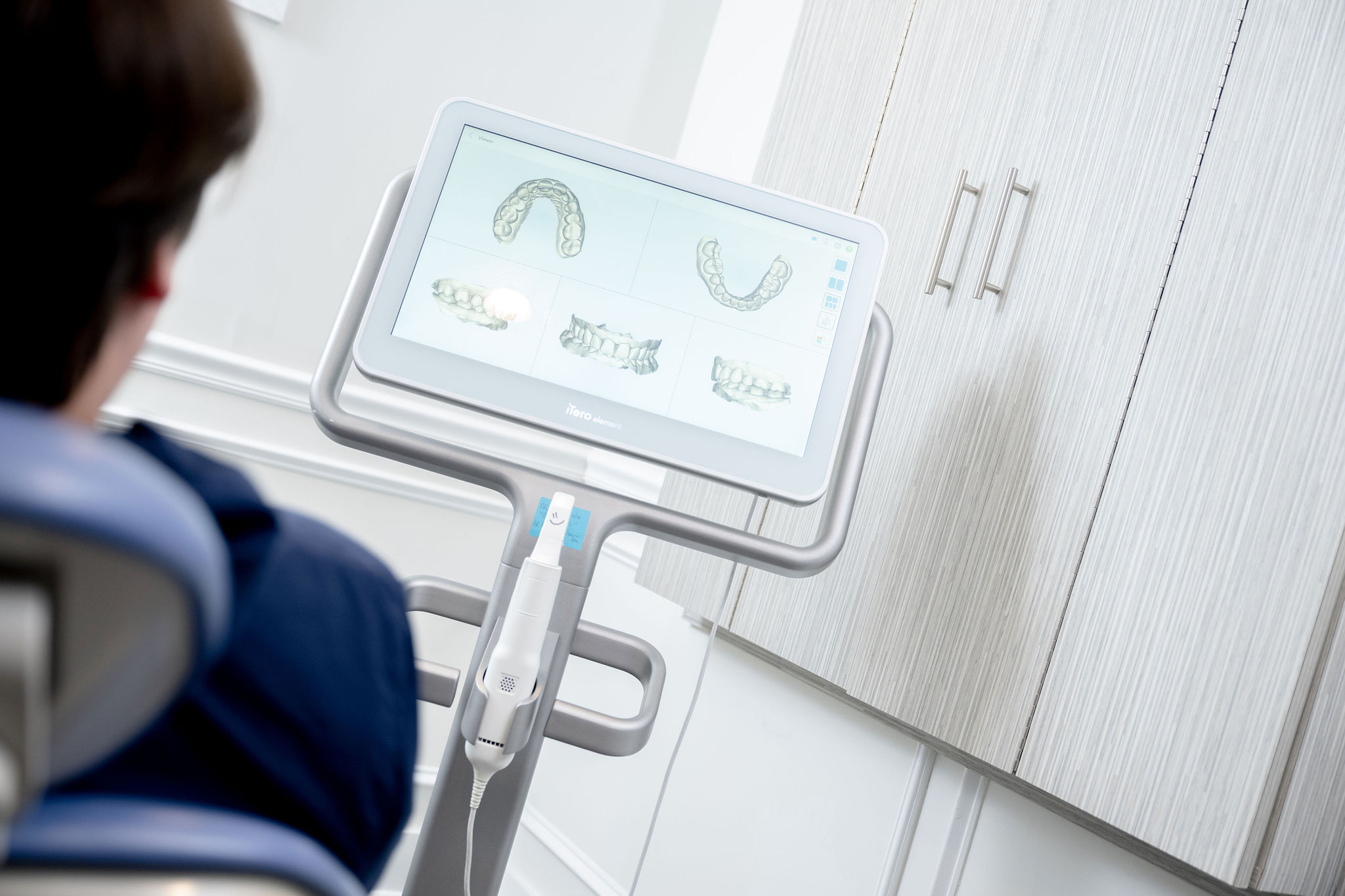 Dental Implants
